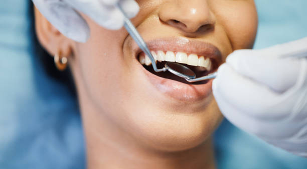Best Emergency Root Canal Treatment in Morton Grove, IL